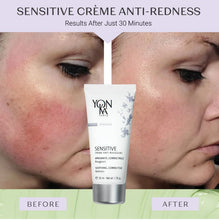 Load image into Gallery viewer, Sensitive Creme Anti-Red
